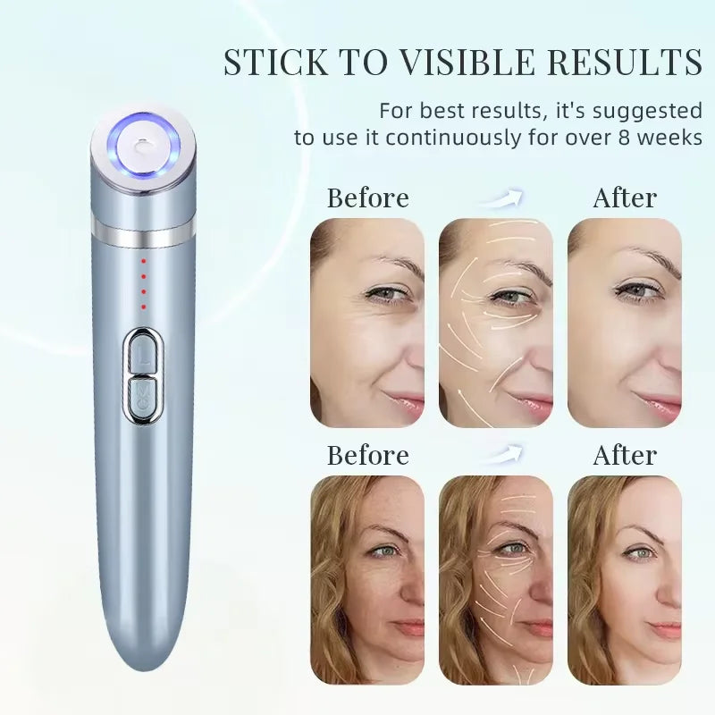 EMS Eye Massager Anti-aging Beauty Instrument Eye Care Massage