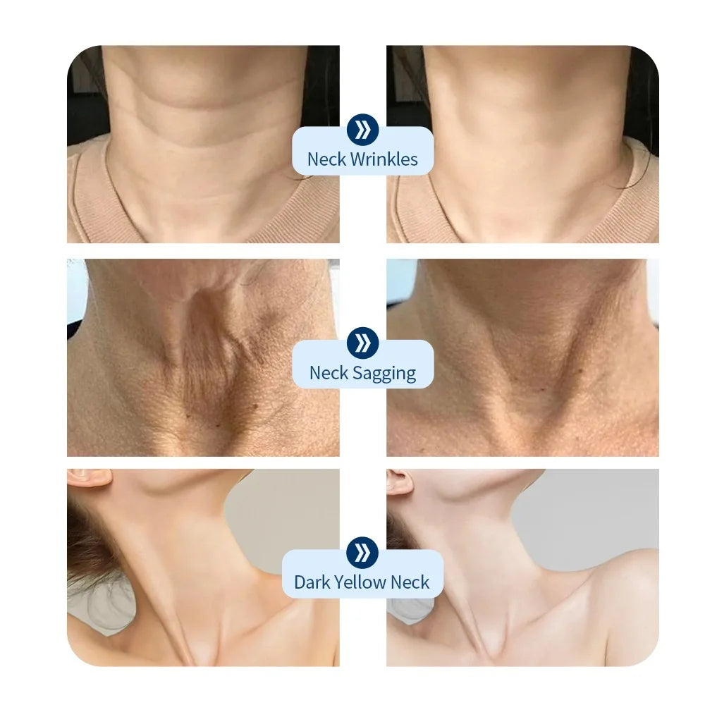 Neck LED Lift Mask Photon Anti-Wrinkle Skin Tightening