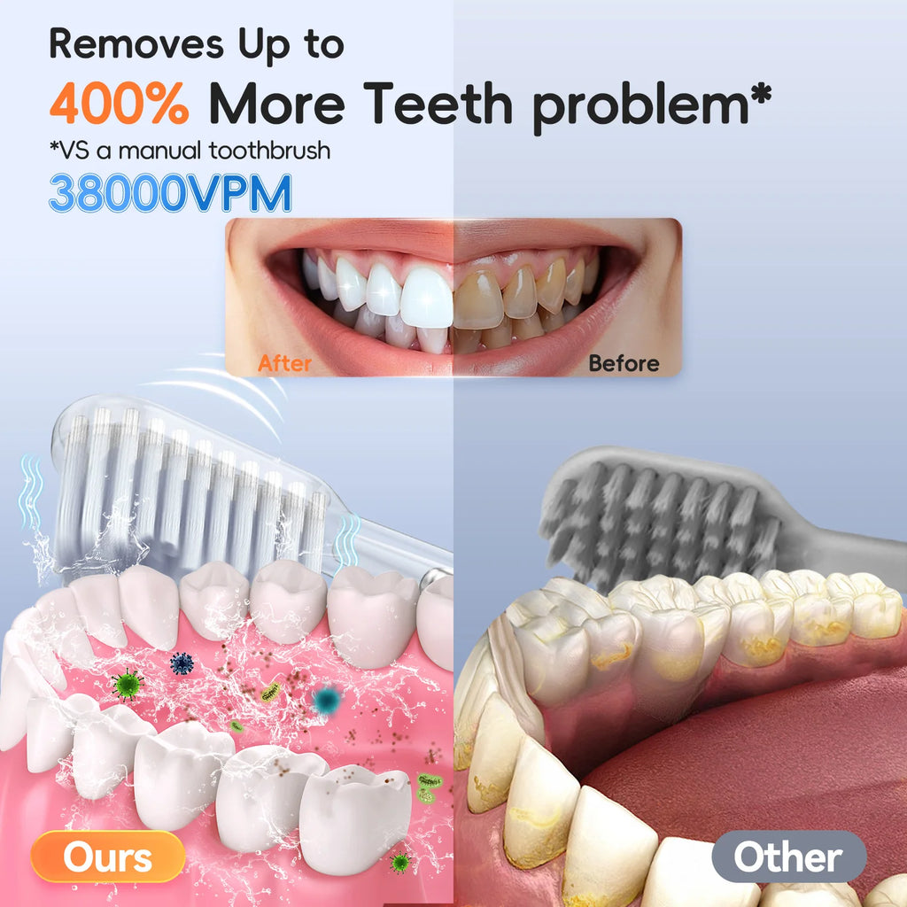 Nasal Irrigation System–Rinse Kit with 1 Nose Cleaner and 30 SaltPods for Congestion Relief Sinus with Electric Toothbrush Set